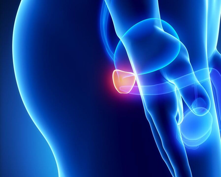 Inflamación de la próstata